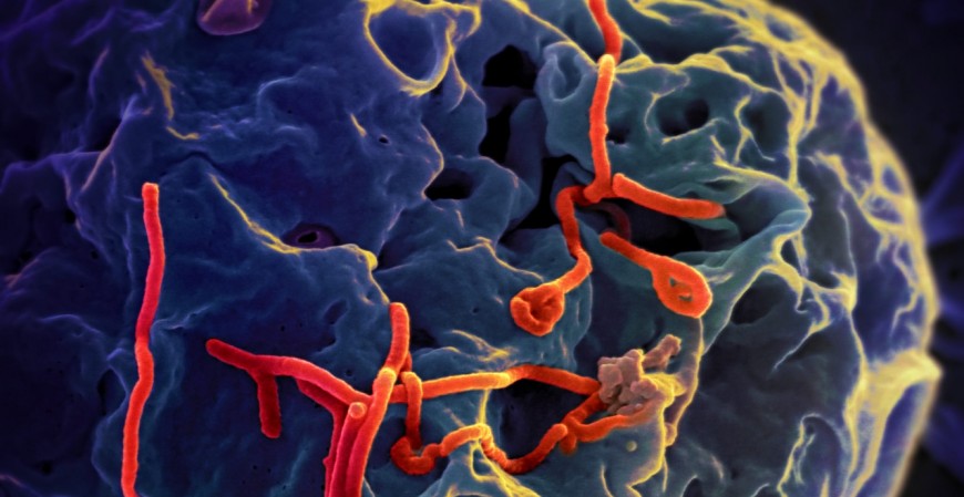 Un test para detectar el ébola con una tira de papel