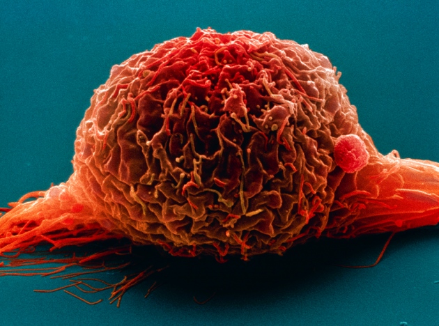 Immune system offers clues to cancer treatment