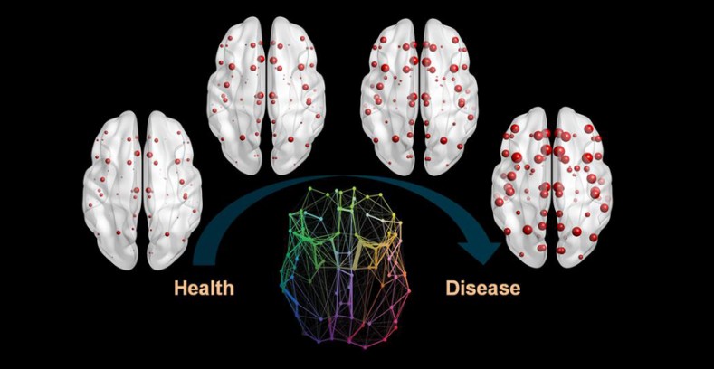 Las proteínas vinculadas al alzhéimer se propagan en el cerebro como una epidemia