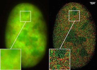 Seeing Inside Cells