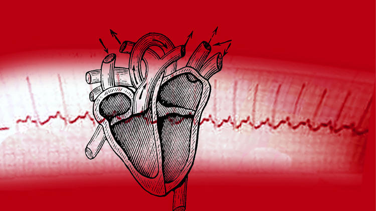 Some heart patients do better when the cardiologist is away