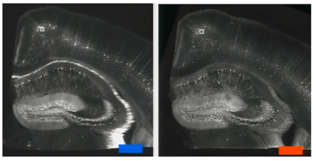 Blown-up brains reveal nanoscale details