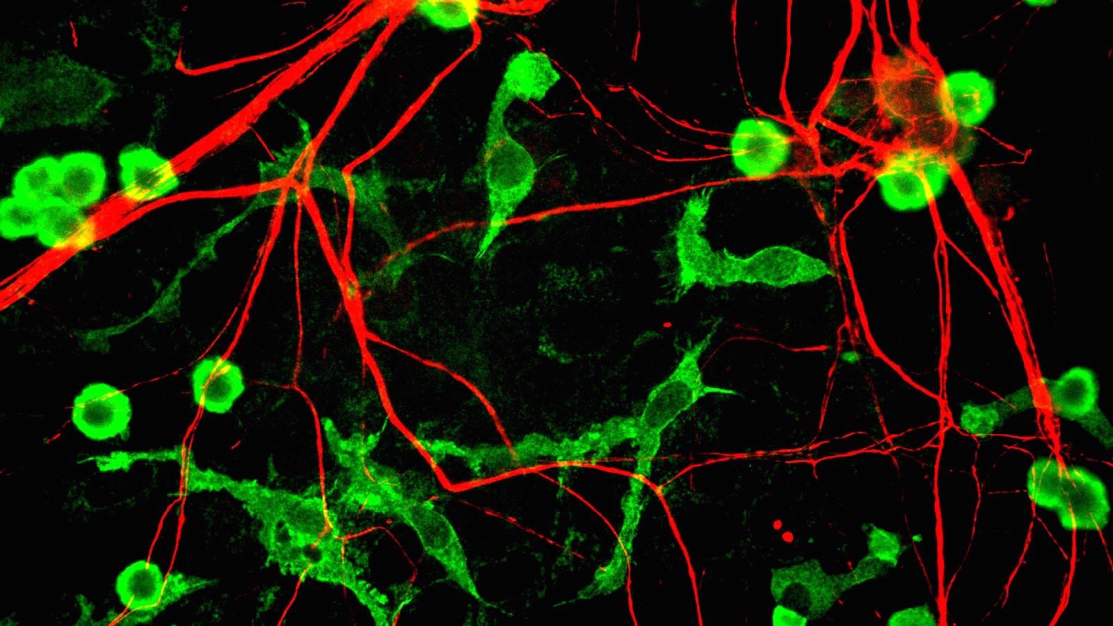 An Inflammatory Theory of Brain Disease