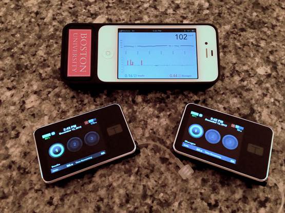 Building a Bionic Pancreas