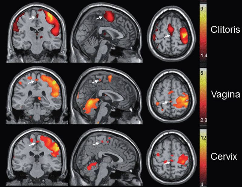 This is what your brain looks like during an orgasm