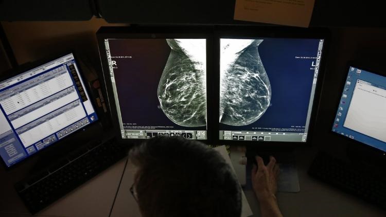 To find breast cancer, more mammograms aren’t better, expert panel says