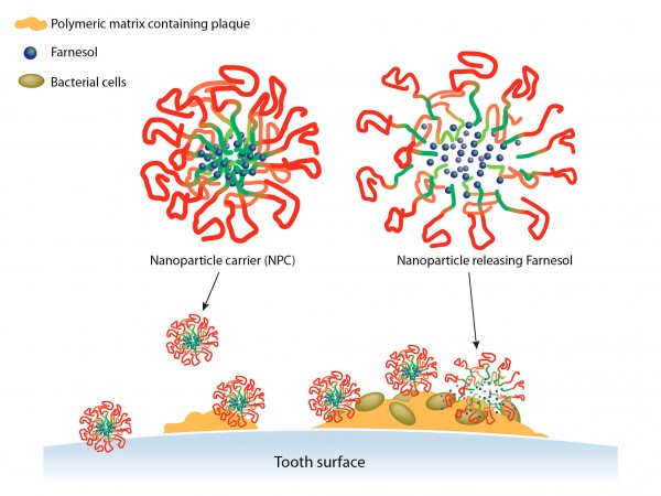 Plaque-busting nanoparticles could help fight tooth decay