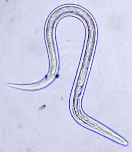 Parasites Found to Influence Fertility in Women