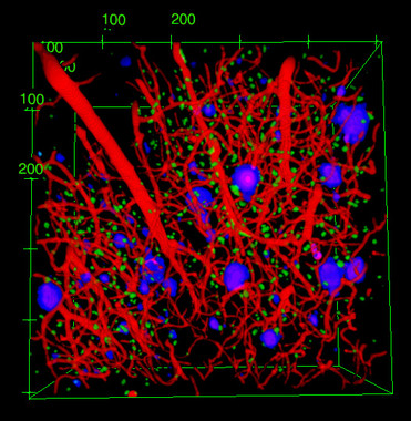 Un estudio de las células del cerebro podría cambiar la lucha contra el alzhéimer