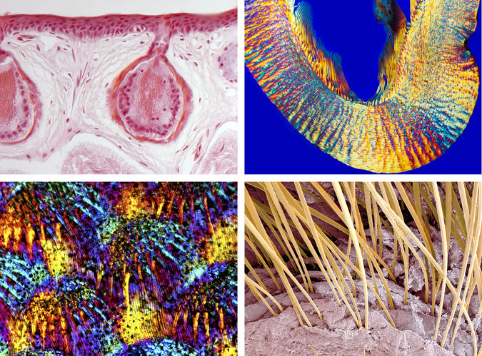 Genetic Flip Helped Organisms Go From One Cell to Many