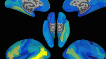 [:es]How the Brain Decodes Sentences[:]