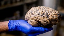 [:eu]Learning to read and write alters brain wiring within months, even for adults[:]