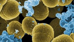 [:eu]Cómo es el ciclo de vida de los virus que infectan ‘Staphylococcus aureus’[:]