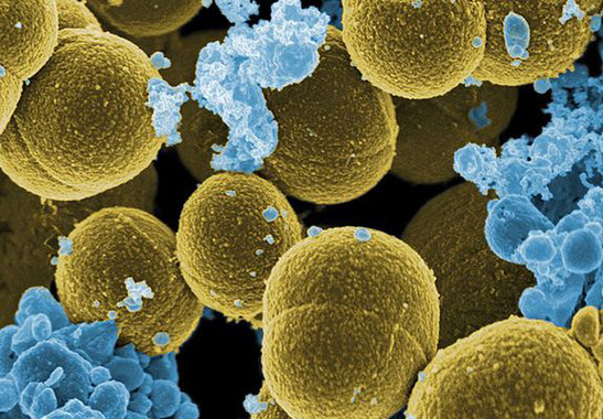 [:eu]Cómo es el ciclo de vida de los virus que infectan ‘Staphylococcus aureus’[:]