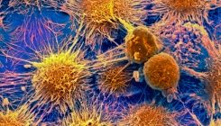 [:eu]Next-generation cancer drugs boost immunotherapy responses[:]