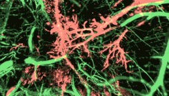 [:eu]Cancer-vision, brought to you by transparent mice[:]