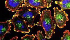 [:eu]Prueban con éxito dos prototipos de vacuna para el cáncer de piel[:]