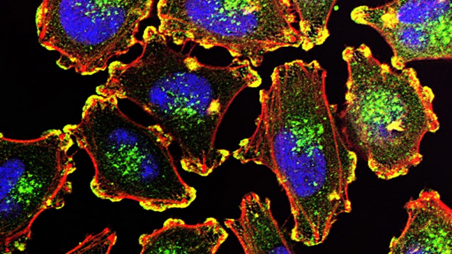 [:eu]Prueban con éxito dos prototipos de vacuna para el cáncer de piel[:]