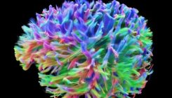[:eu]What the brain’s wiring looks like[:]
