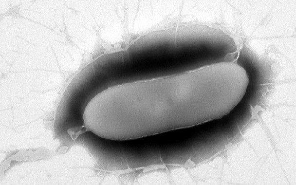 [:es]Descrita una nueva especie de bacteria en la Antártida[:]