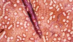 [:es]Gut microbes could help trigger multiple sclerosis[:]