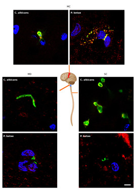 [:es]Investigadores españoles relacionan la ELA con hongos en el cerebro[:]