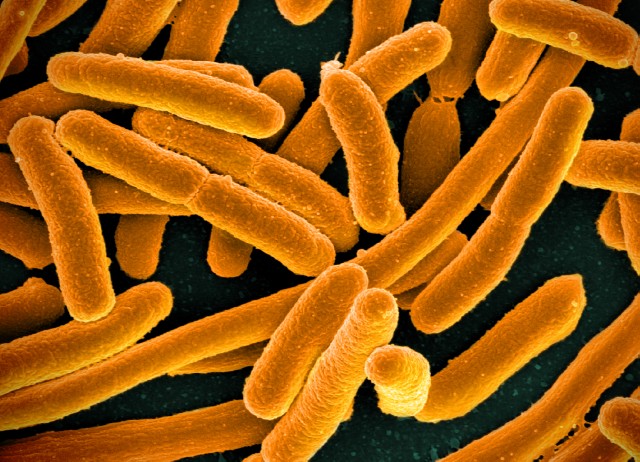 [:es]¿Por qué hay un montón de voluntarios comiendo ‘E. Coli’ modificada genéticamente?[:]