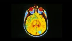 [:es]Could Brain Scans Determine Guilt or Innocence in Court?[:]