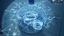 [:es]Imágenes del cerebro refutan una teoría de los años 60 sobre el dominio del lenguaje[:]