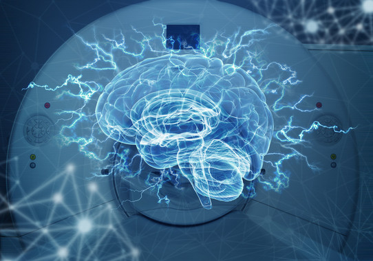 [:es]Imágenes del cerebro refutan una teoría de los años 60 sobre el dominio del lenguaje[:]