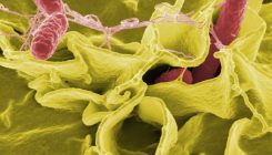 [:es]La salmonela causó una de las epidemias más devastadoras del siglo XVI en México[:]