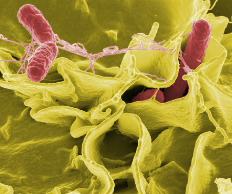 [:es]La salmonela causó una de las epidemias más devastadoras del siglo XVI en México[:]