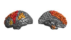 [:es]The world’s largest set of brain scans are helping reveal the workings of the mind and how diseases ravage the brain[:]