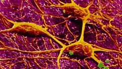 [:es]Artificial neurons compute faster than the human brain[:]