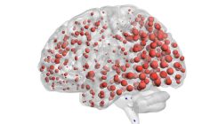 [:es]Alzheimer’s protein may spread like an infection, human brain scans suggest[:]