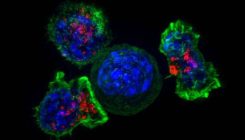 [:es]Immunitate-sistema zahartzea, adinarekin minbizi gehiago izatearen arrazoia[:]