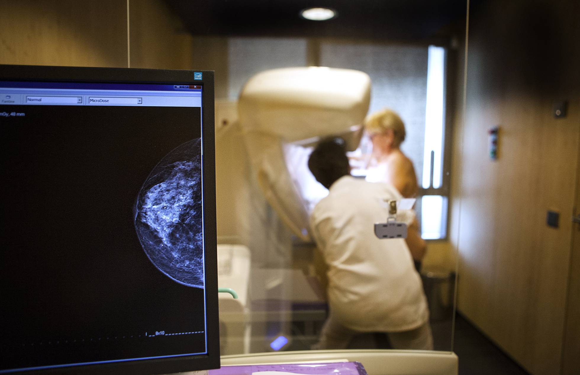 [:es]Las limitaciones de las mamografías[:]