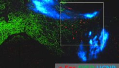 [:es]Luz y nanopartículas para estimular las profundidades del cerebro[:]