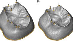 [:es]Primer estudio en 3D de las muelas halladas en la Sima de los Huesos[:]