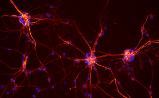 [:es]Un vídeo en tiempo real muestra cómo se reparan las neuronas tras sufrir un daño[:]