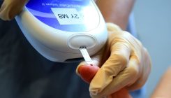[:es] Five categories for adult diabetes, not just type 1 and type 2[:]