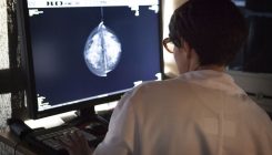 [:es]AI researchers embrace Bitcoin technology to share medical data[:]