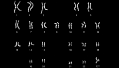 [:es]The Y Chromosome’s Still-Uncharted Regions[:]