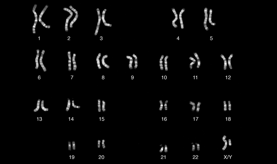 [:es]The Y Chromosome’s Still-Uncharted Regions[:]