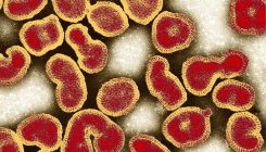 [:es]Flu virus finally sequenced in its native form[:]