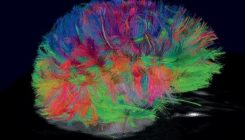 [:es]El cerebro almacena la información como un CD, no como un casete[:]