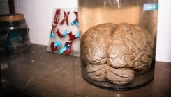 [:es]¿Y si los cerebros de laboratorio producen algo parecido a una consciencia?[:]