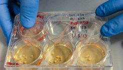 [:es]Neanderthal ‘minibrains’ grown in dish[:]