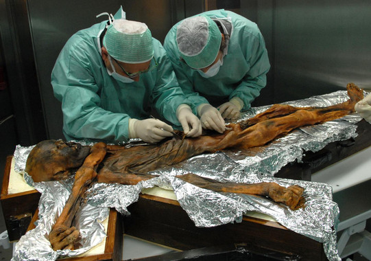 [:es]El último banquete de Ötzi arroja luz sobre la alimentación de hace 5.000 años[:]