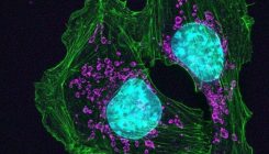 [:es]Cómo entrenar a las células tumorales para hacer frente al cáncer[:]